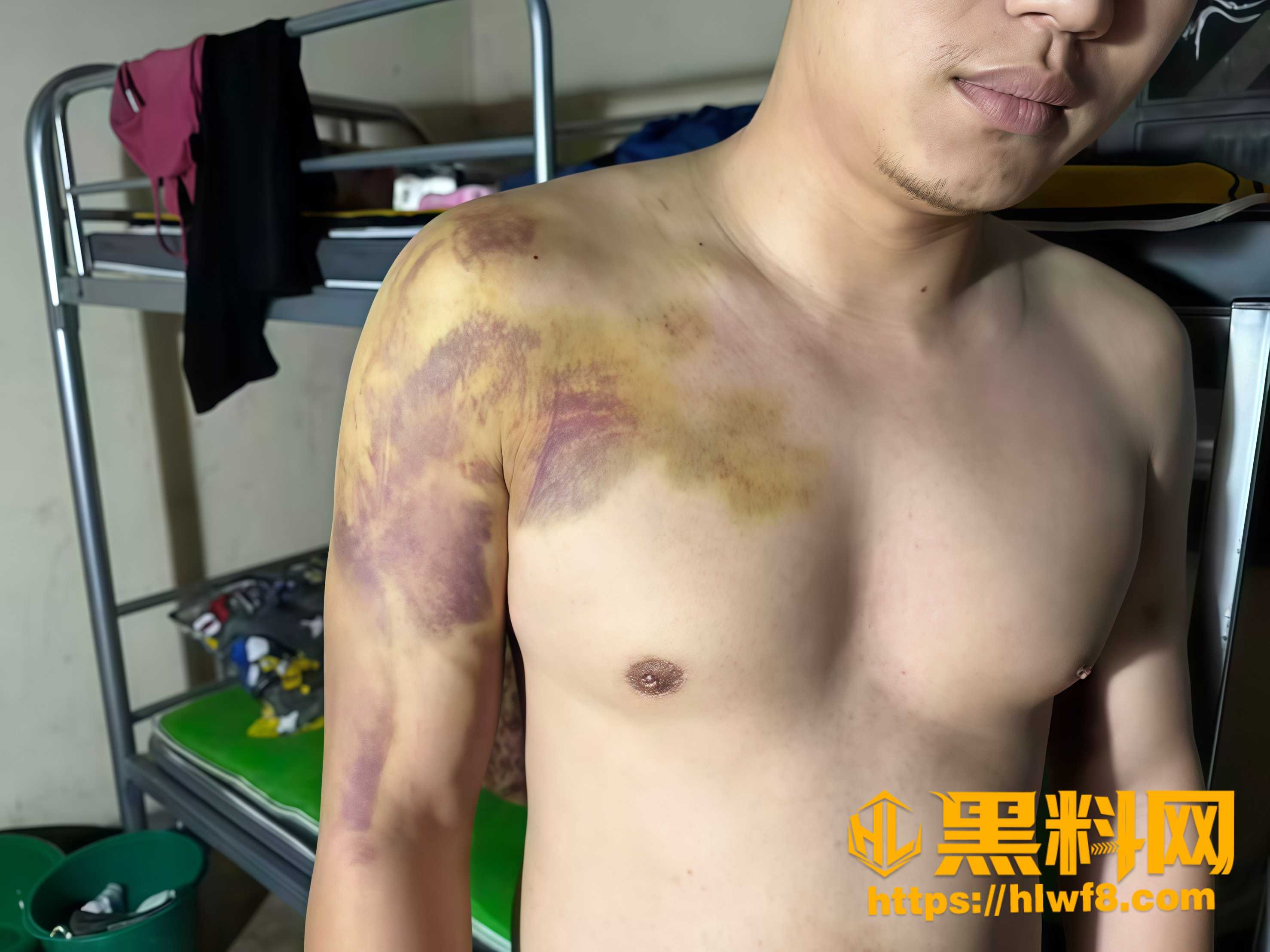 缅甸诈骗园区挨打视频流出3