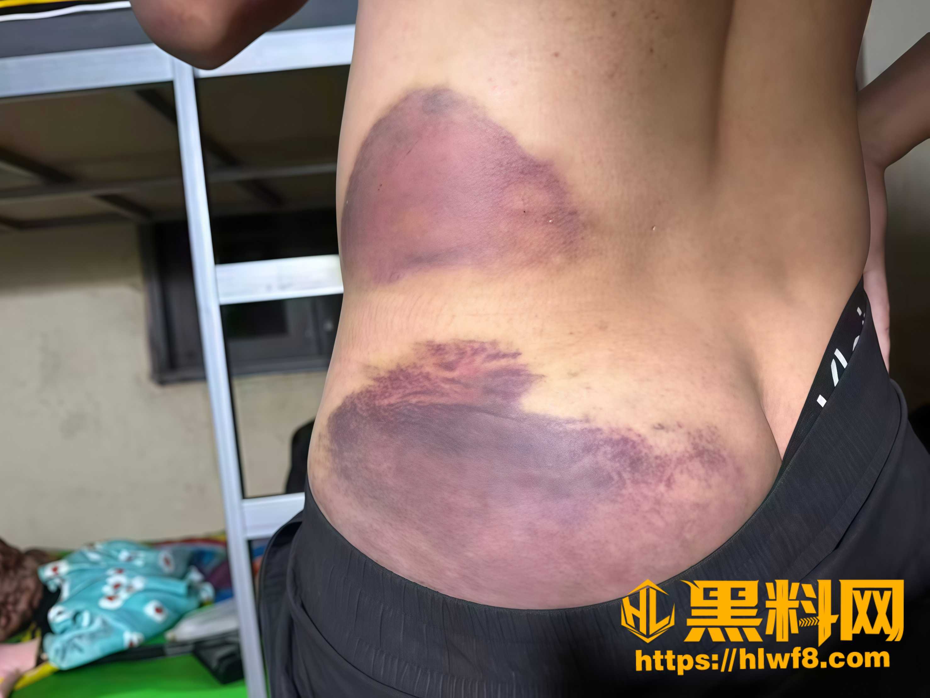 诈骗5
